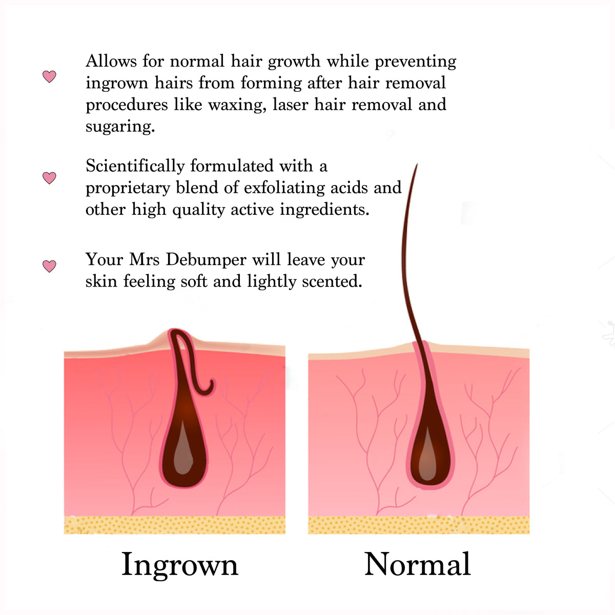 ingrown hair scrotum treatment